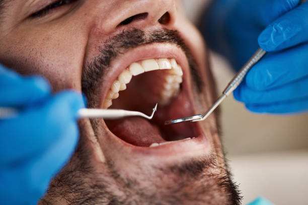 Professional Emergency Dental Service in CA